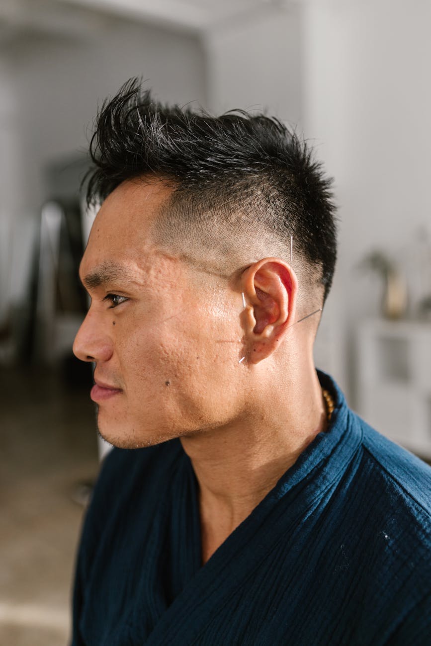 a man with needle on the skin